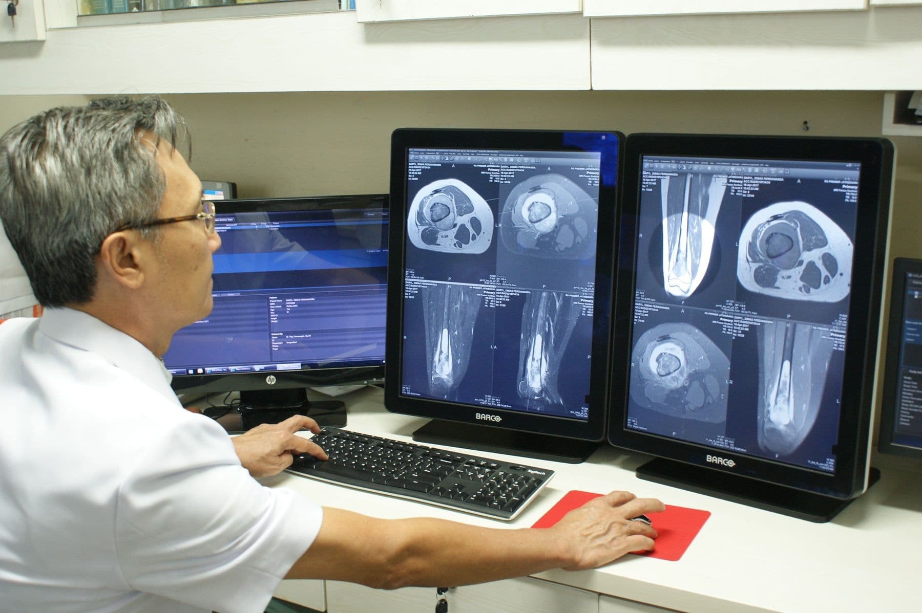 Chuẩn đoán y tế bằng thị giác máy