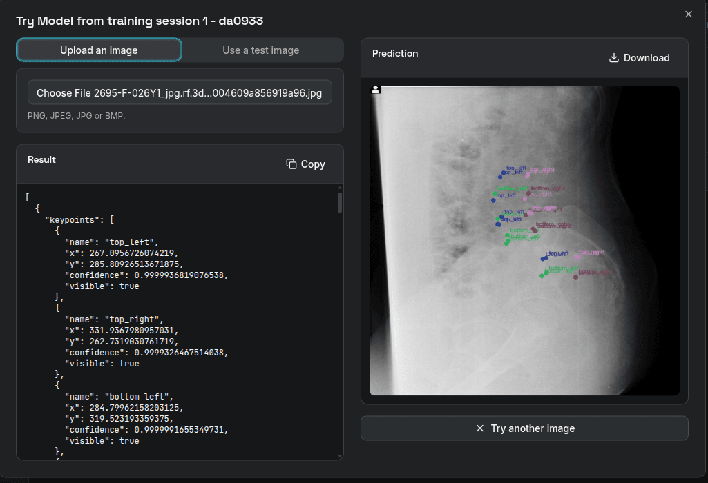 Keypoint inference on a lateral spine X-ray, with named landmarks returned as JSON
